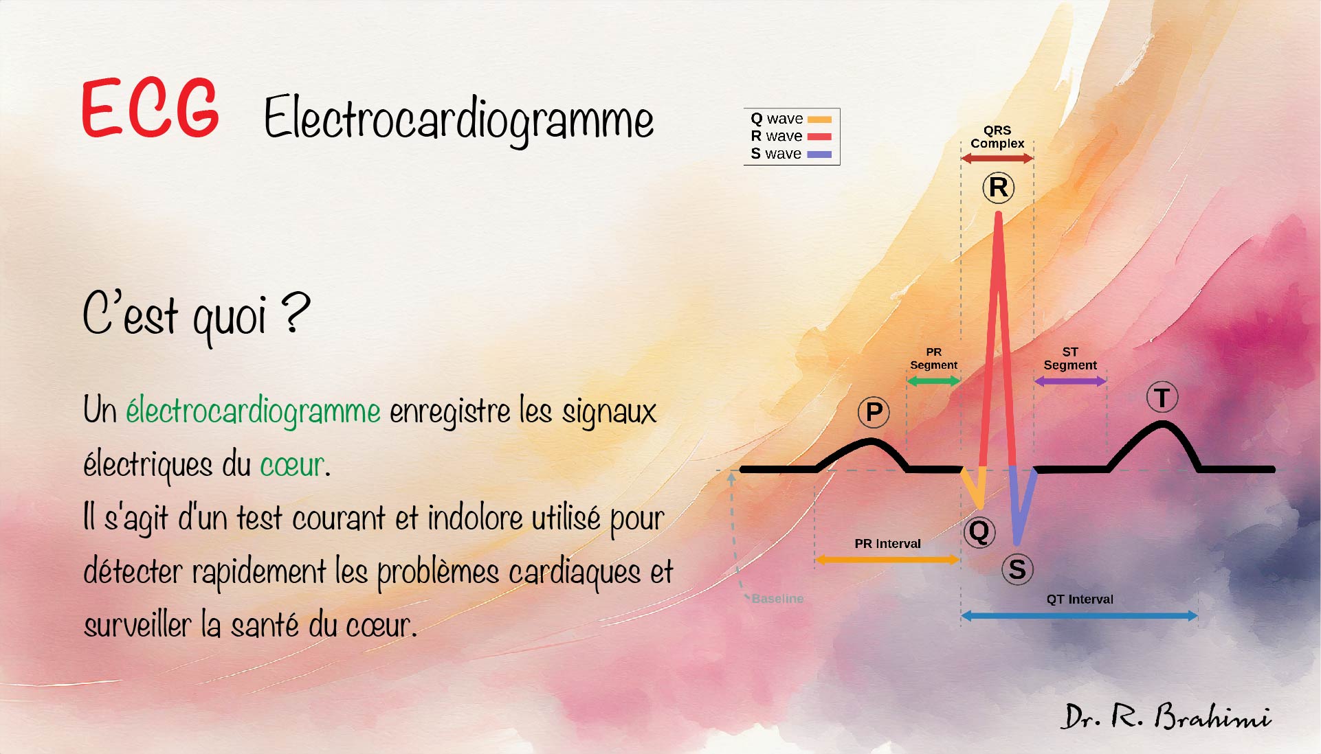 ecg definition