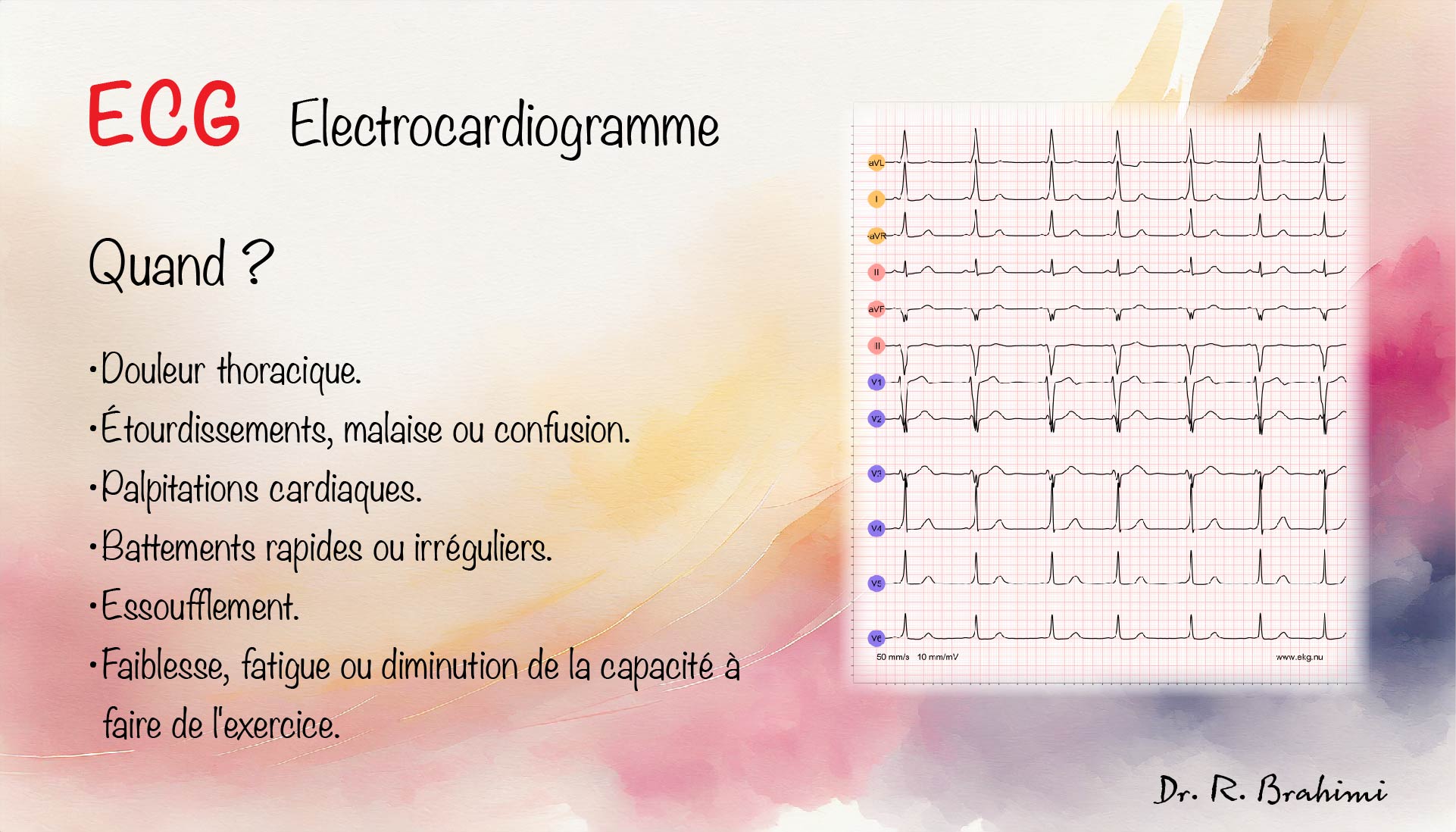 ecg when